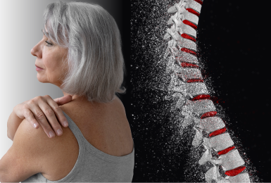 Osteoporose: entenda mais essa doença!